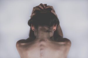 ワキガのミラドライ治療後、痛みはいつまで続くのか？