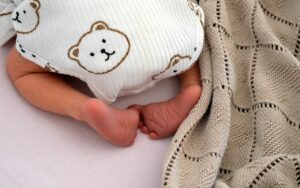 腋臭症のミラドライは足臭は別問題、何をすべき？