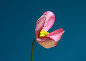 腋臭症のミラドライ施術前の運動は何日前から控えるべき？
